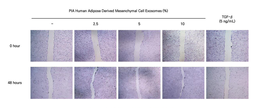 PIA Human Adipose Derived Mesenchymal Cell Exosomes